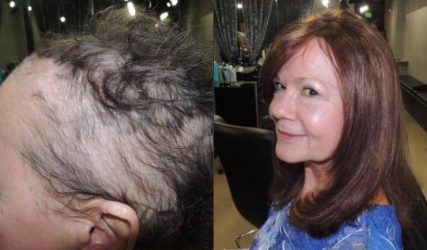 Before and After