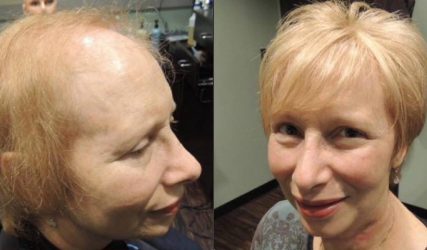 Before and After