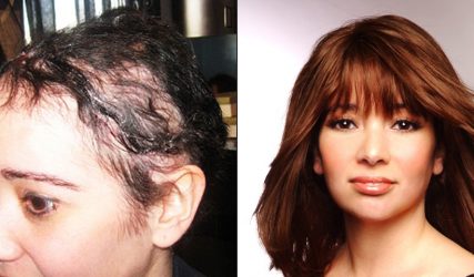 Before and After