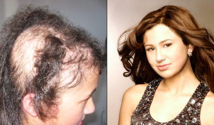 Before and After