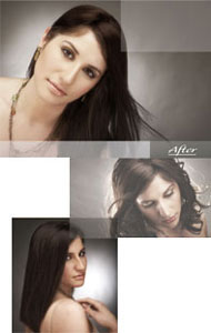 Hair loss - after